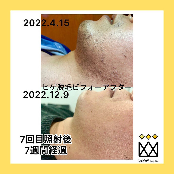 画像416