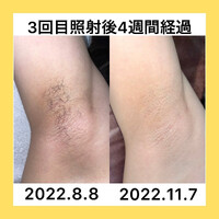 画像428