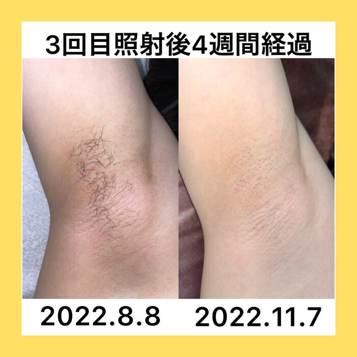 画像428