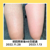 画像430
