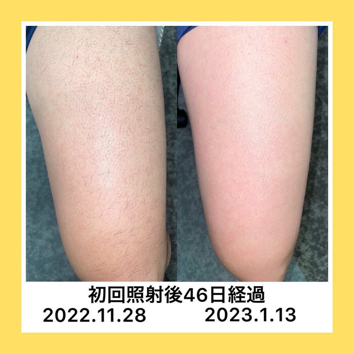 画像430
