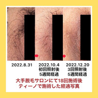 画像432