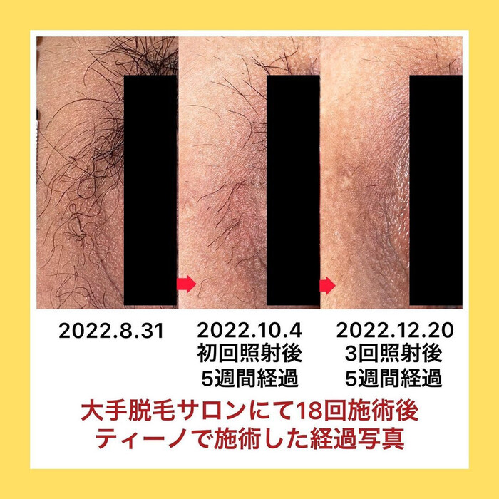 画像432