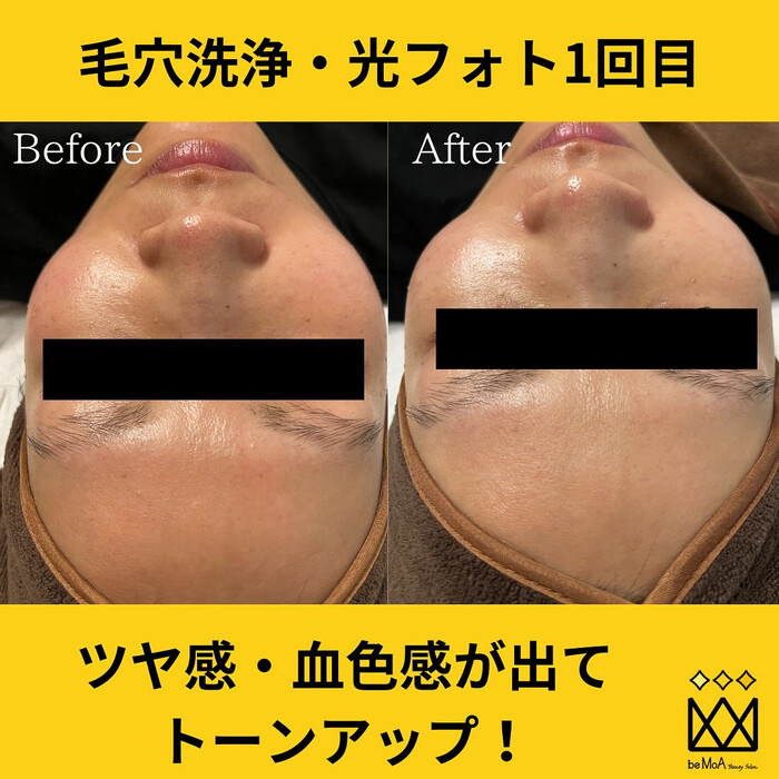 画像567
