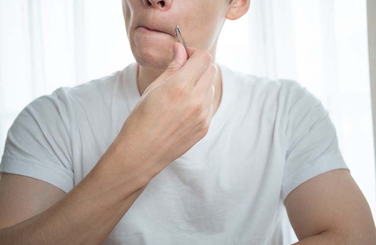 髭、毛抜きで処理していませんか？毛抜き処理をオススメしない理由